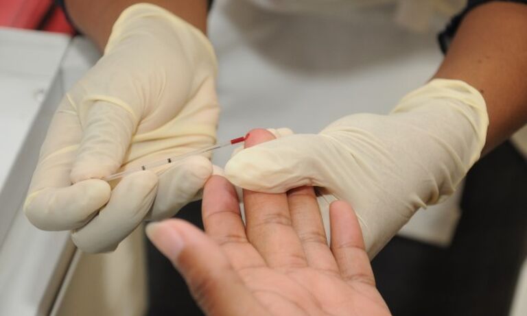 Botswana’s HIV response impacted by COVID-19